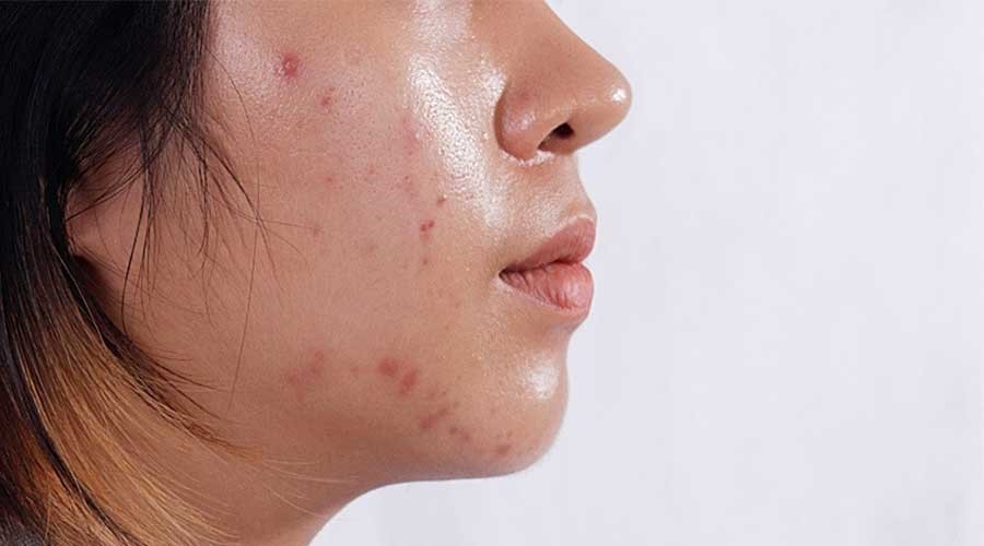 Dưỡng ẩm da đúng cách: Nền tảng quan trọng nhất để có làn da khỏe đẹp